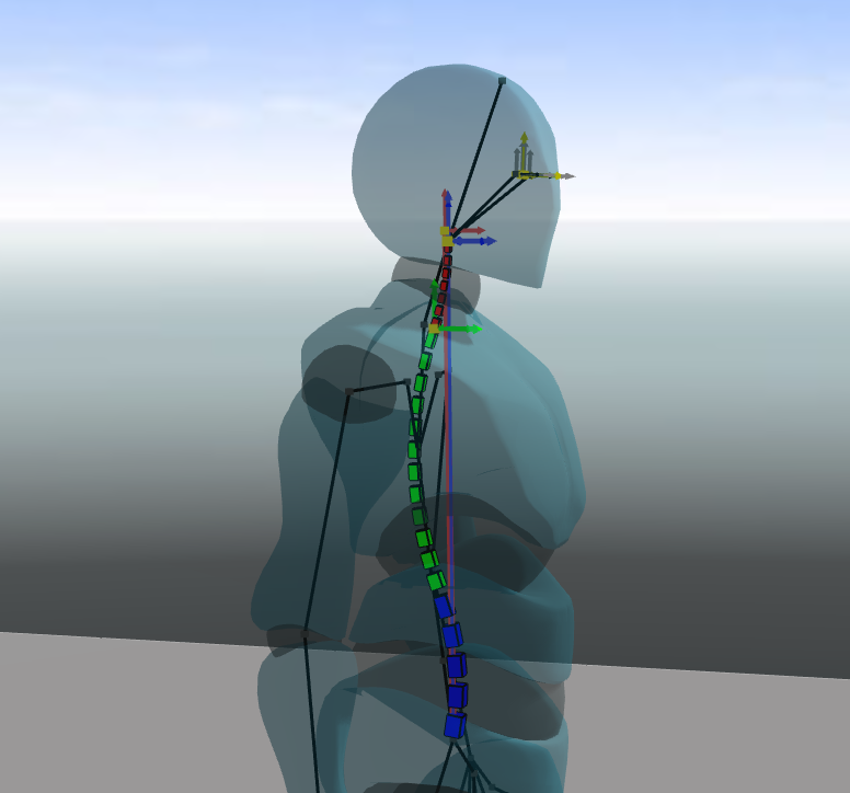 procedural spine